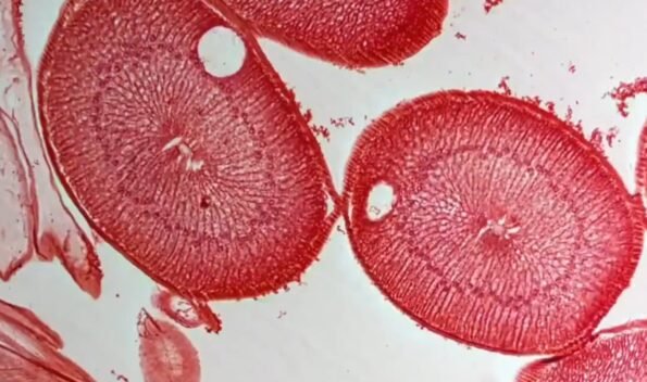 癌症就是寄生虫，寄生虫就是癌症 - deepak.icu