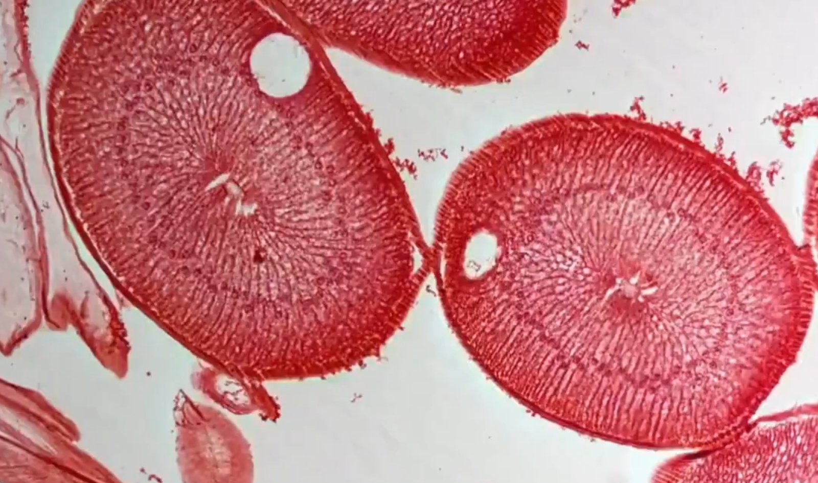 癌症就是寄生虫，寄生虫就是癌症 - deepak.icu